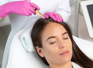 Stem Cell Therapy for Hair Loss: Pros and Cons stem cell therapy for hair loss.